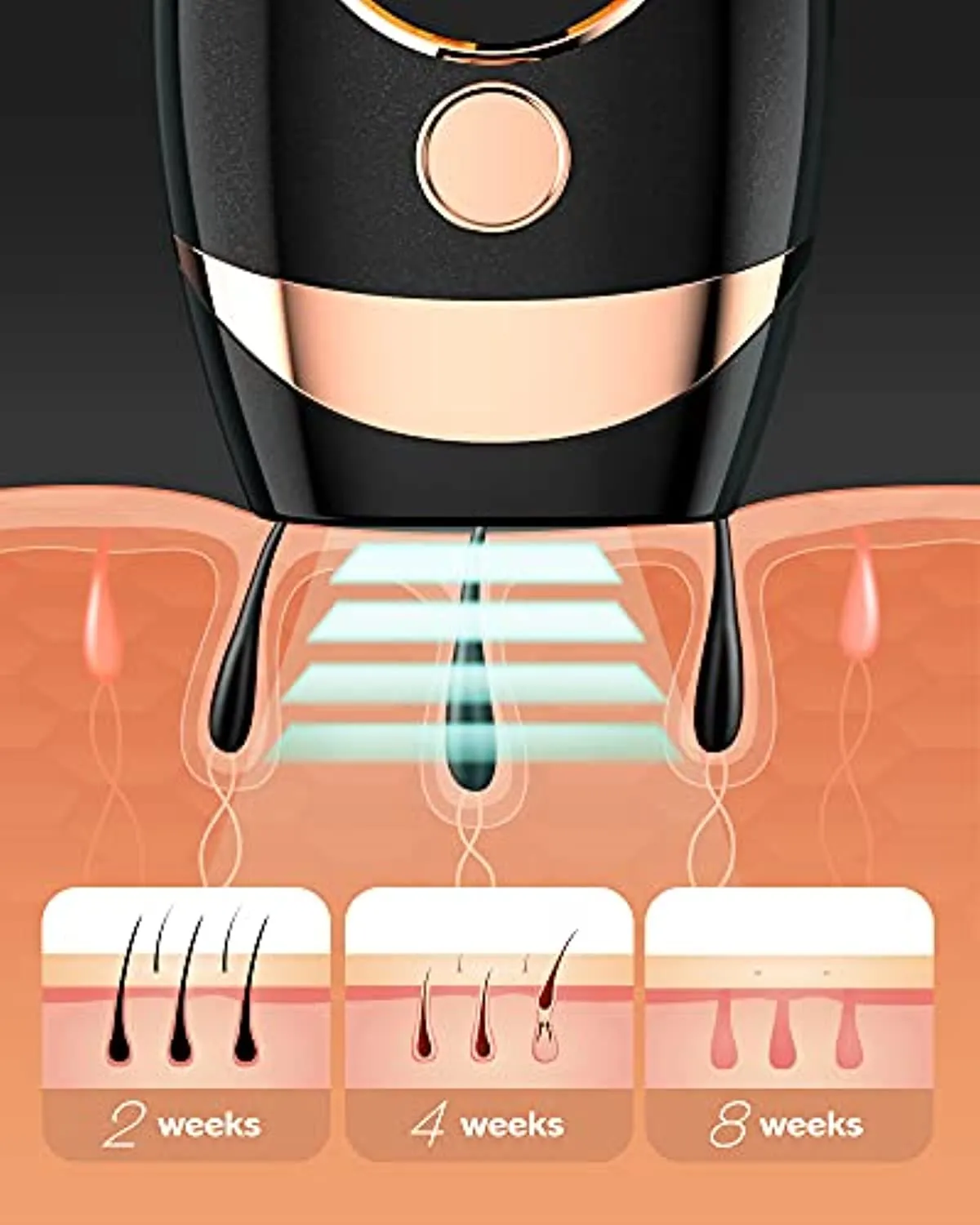 IPL Hair Removal for Women and Men at-Home,Upgrade to 999,000 Flashes Permanent Hair Removal,Painless Hair Remover Device for Armpits Legs Arms Bikini Line and Facial Whole Body
